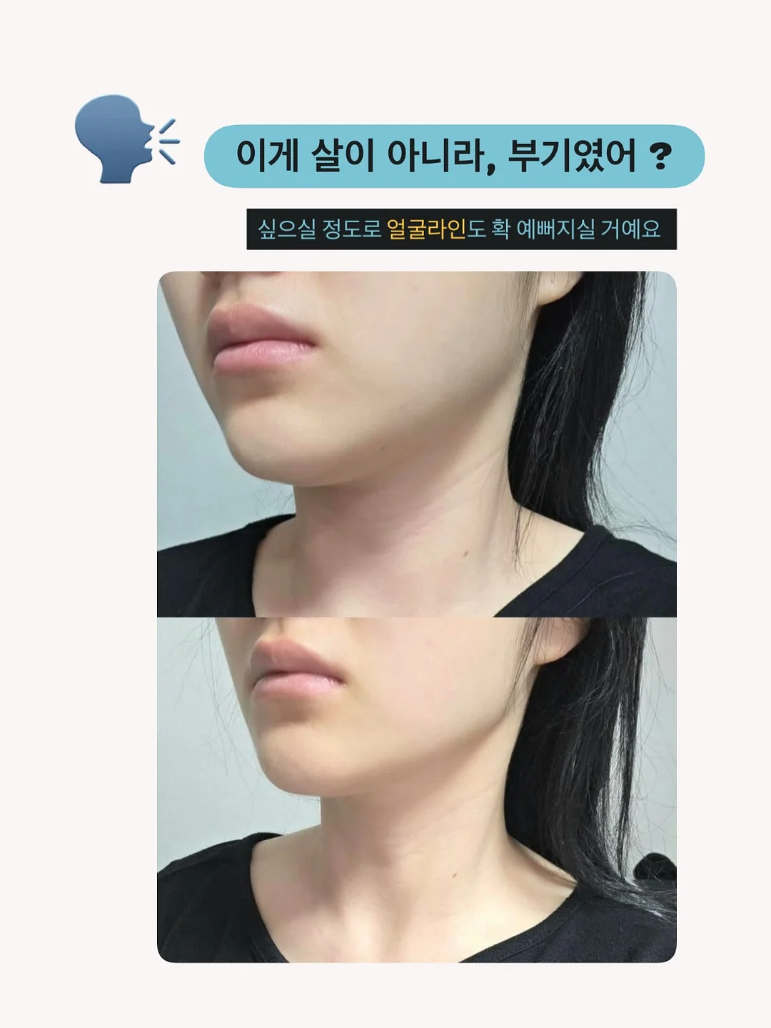 보르르 베이비바우처 11