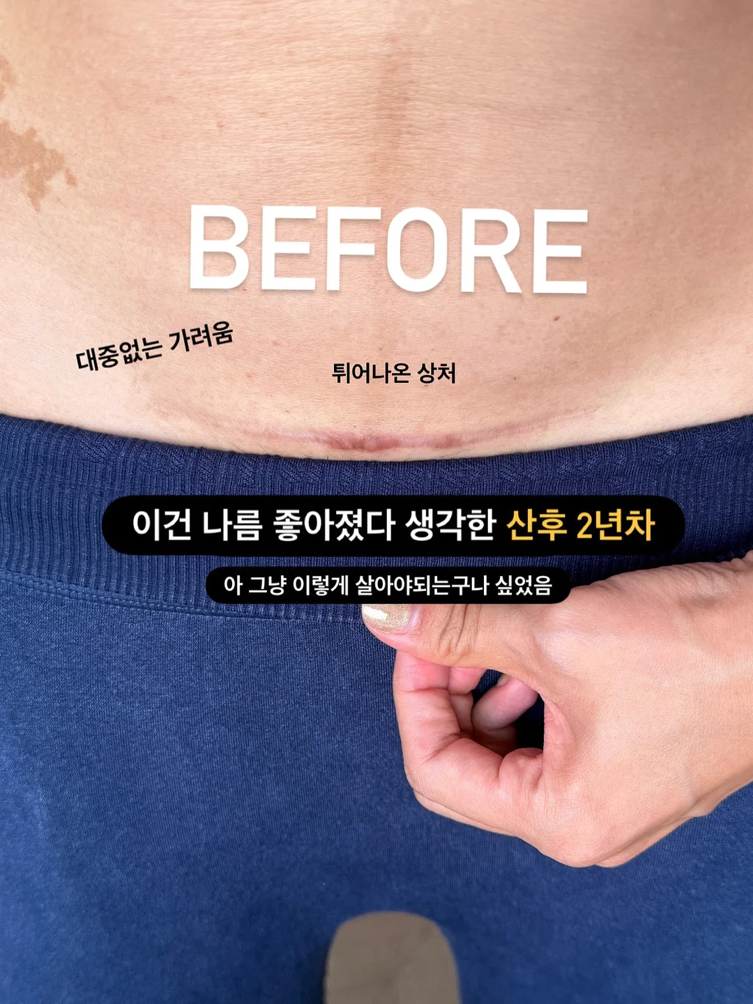 나물 무친 스텐볼 21센치 2