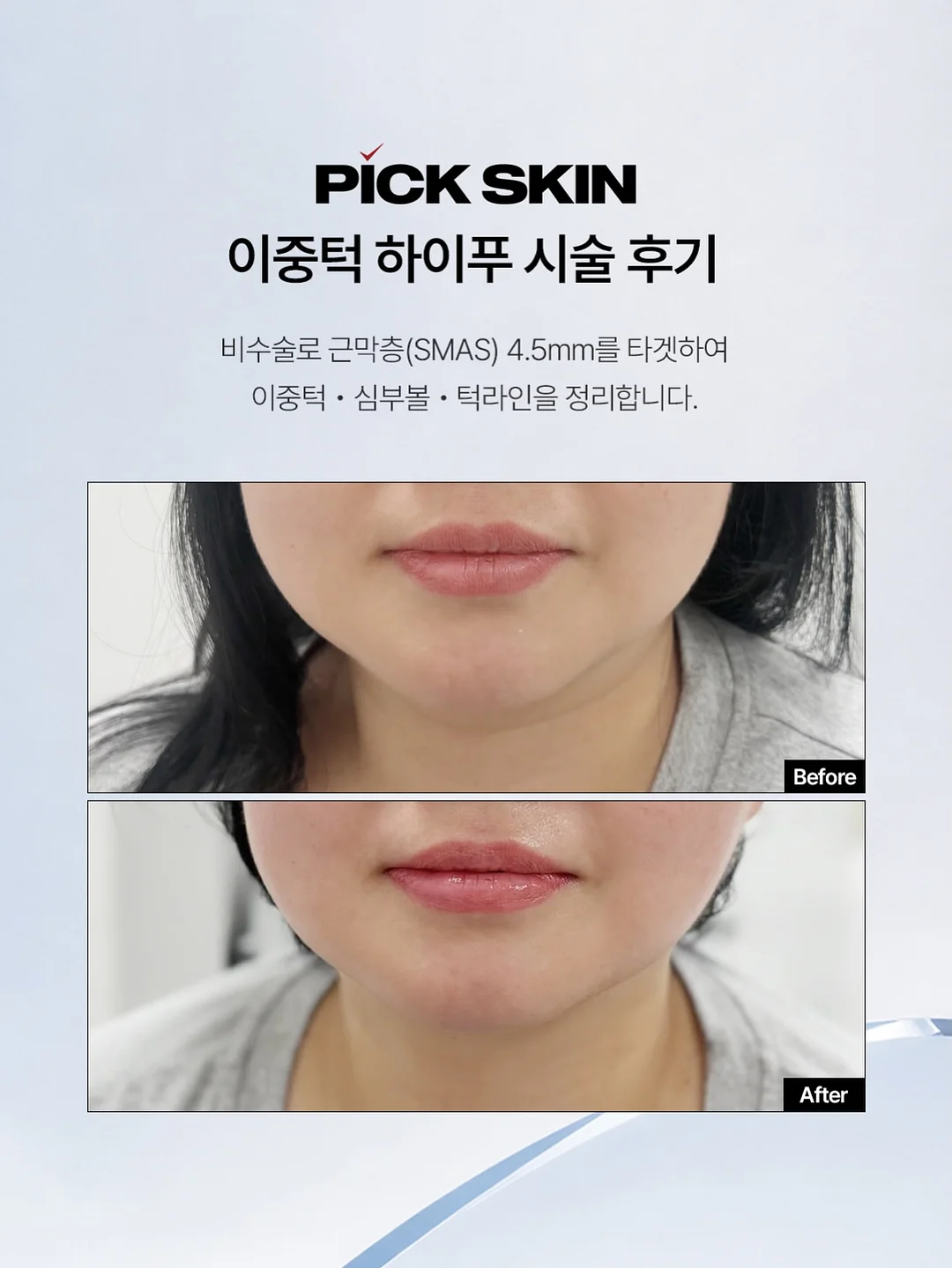 무항생제 한돈 갈비찜