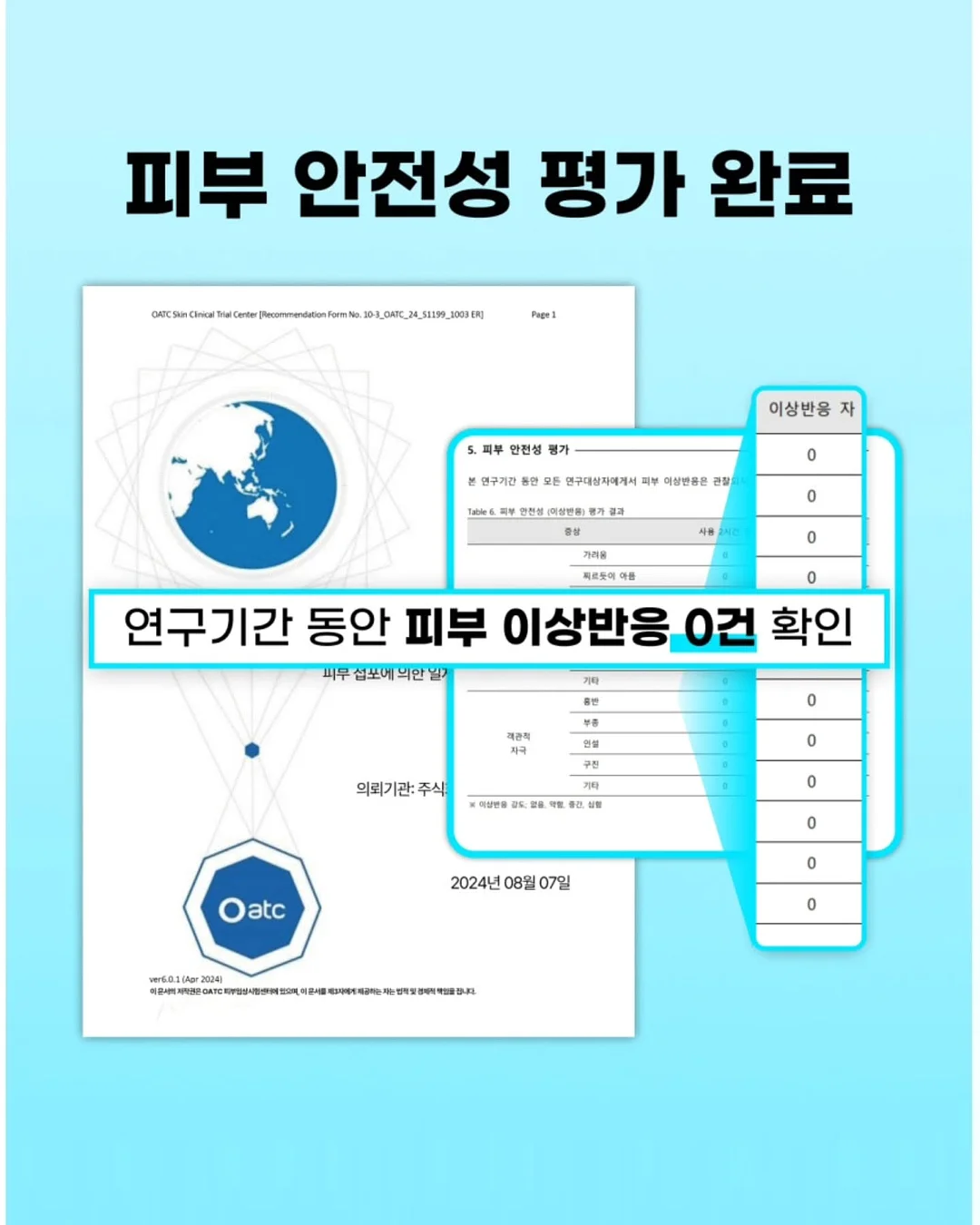쥬시 반팔 원피스 6