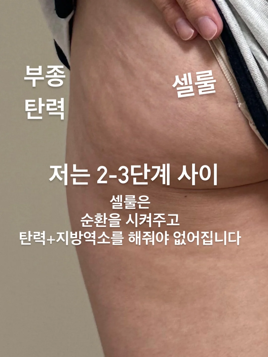 디즈니 레인코트 세트 3