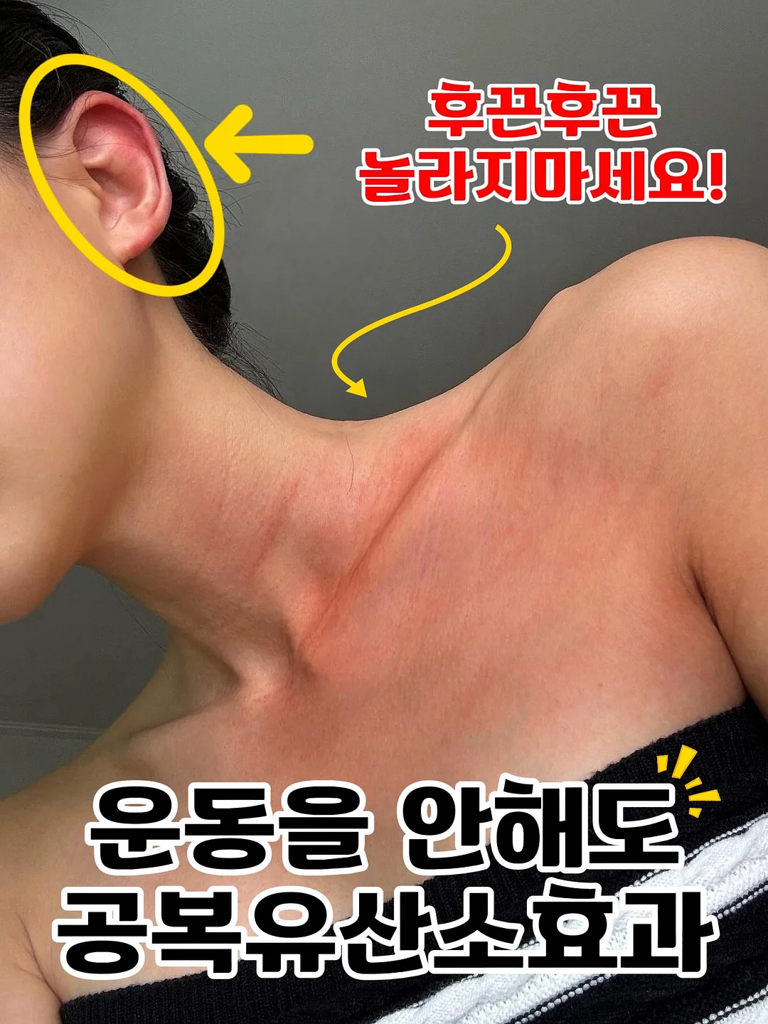 후두부 승모근 관리 1