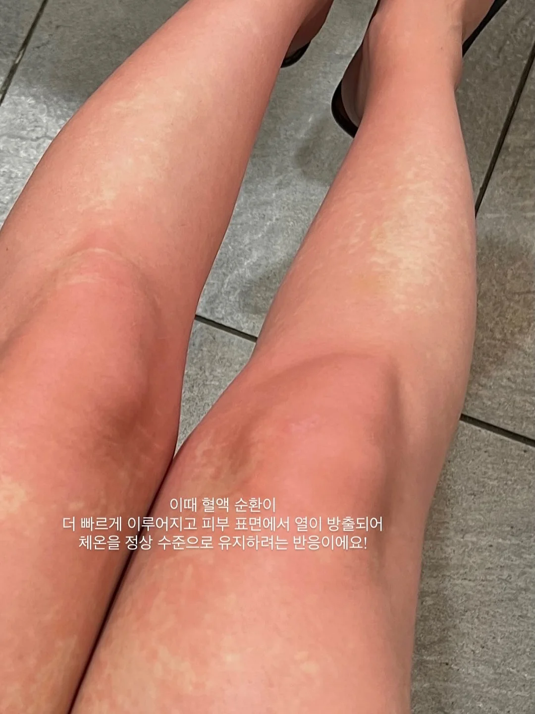 후두부 승모근 관리 6