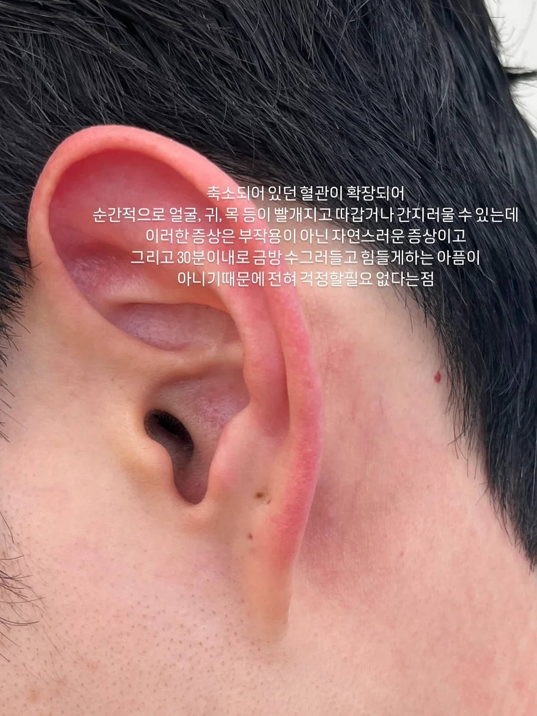후두부 승모근 관리 8