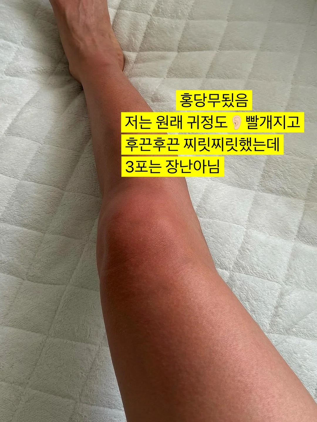 후두부 승모근 관리 10