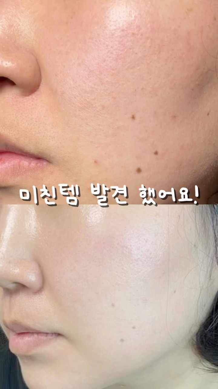 밤켈 쿨러