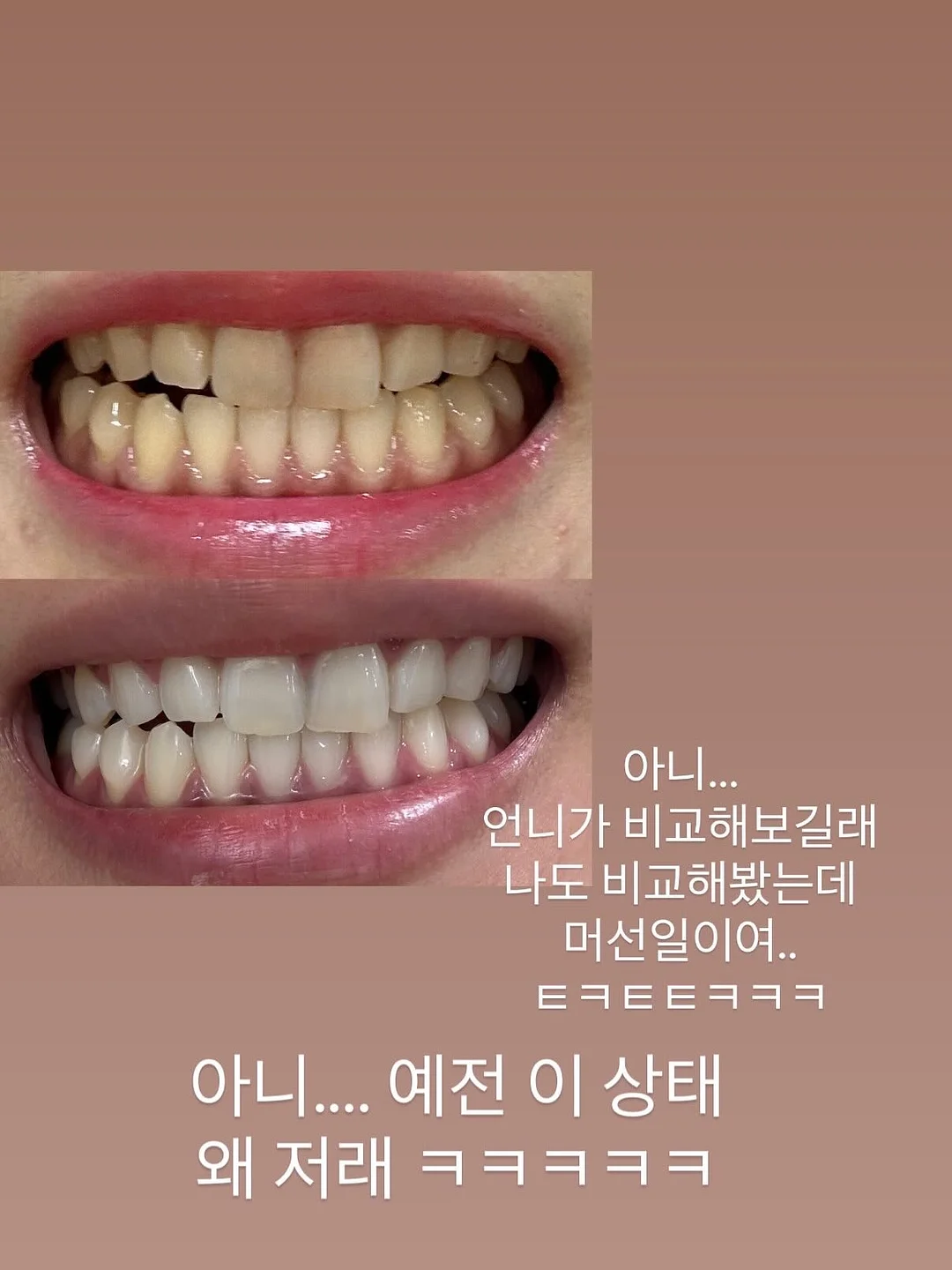 9알 답례품 2