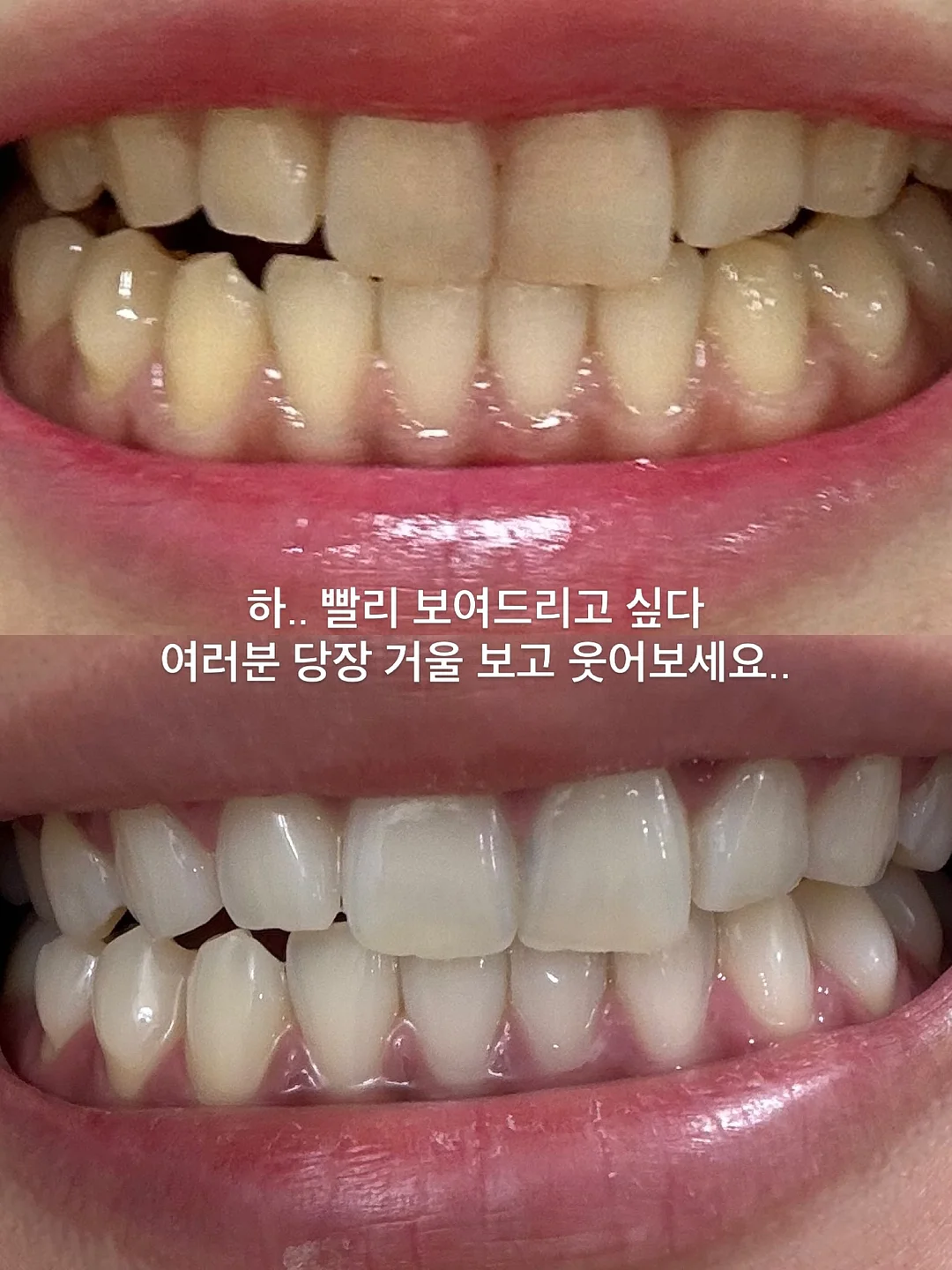 9알 답례품 3