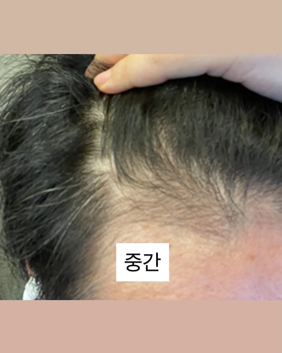 가디건 원피스 7