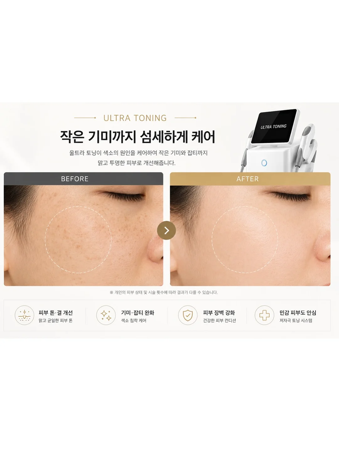 사진 화질 복구 프롬프트 5