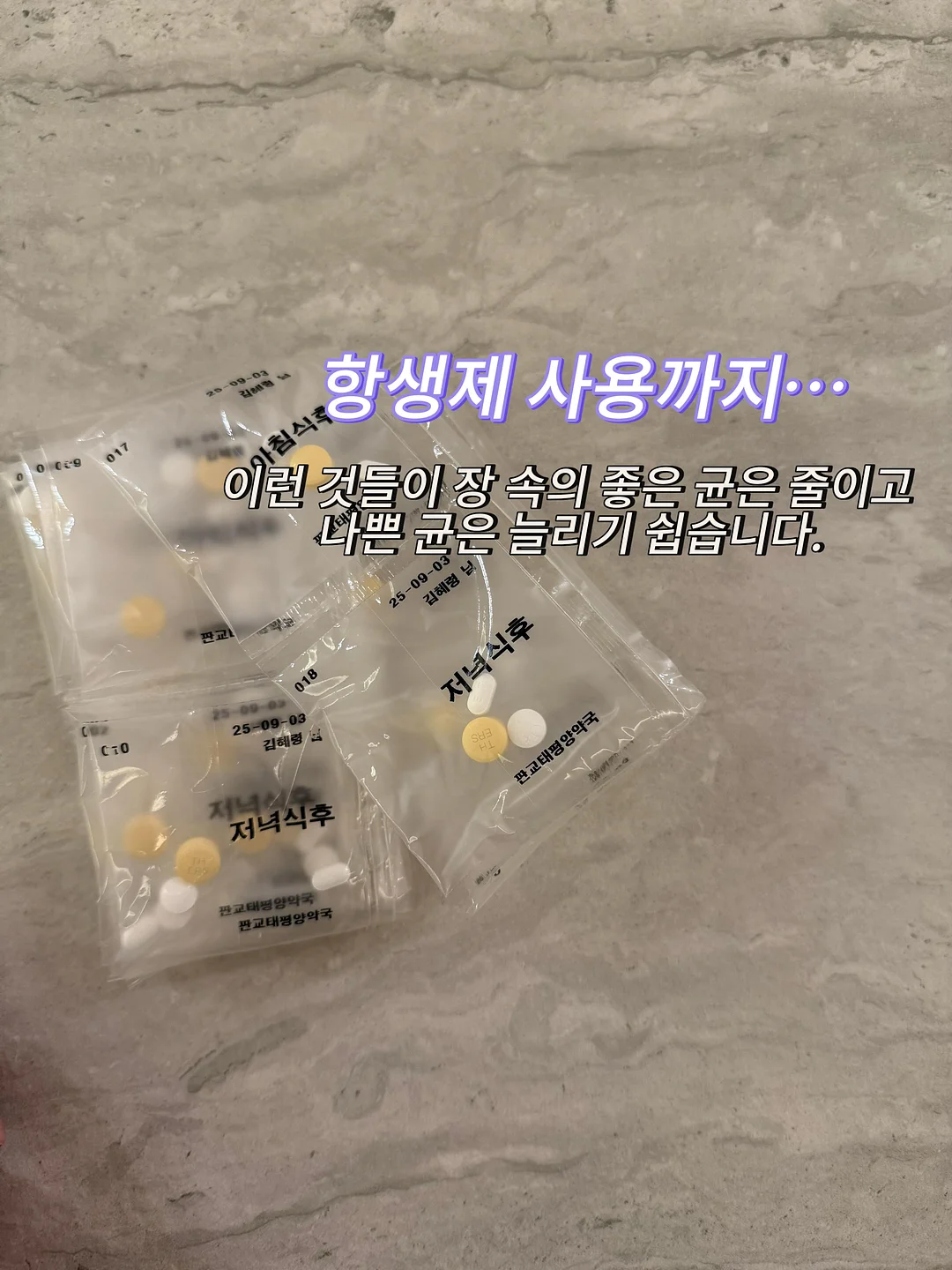 체중감량 보조제 10