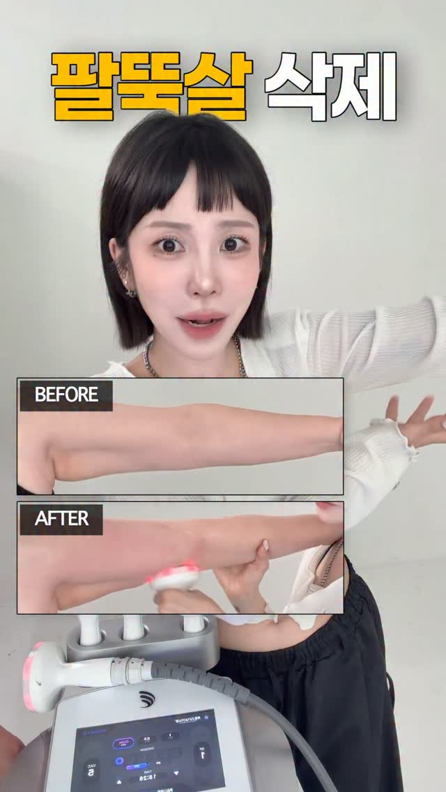 요루면 잠옷