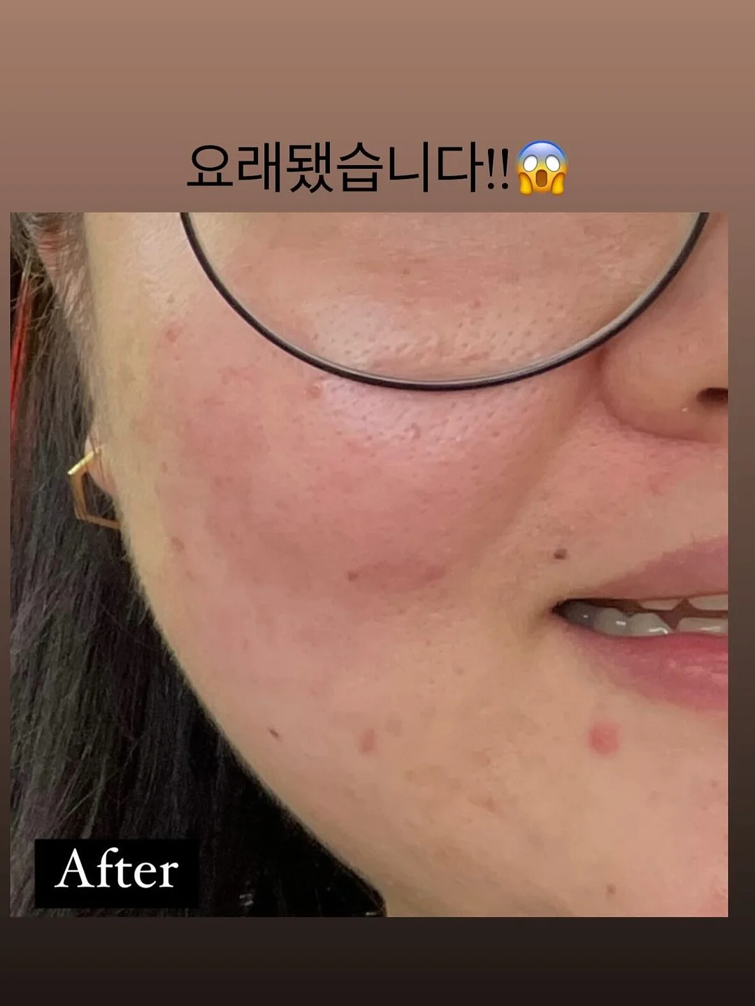 SABU 테니스 리턴볼 세트 3