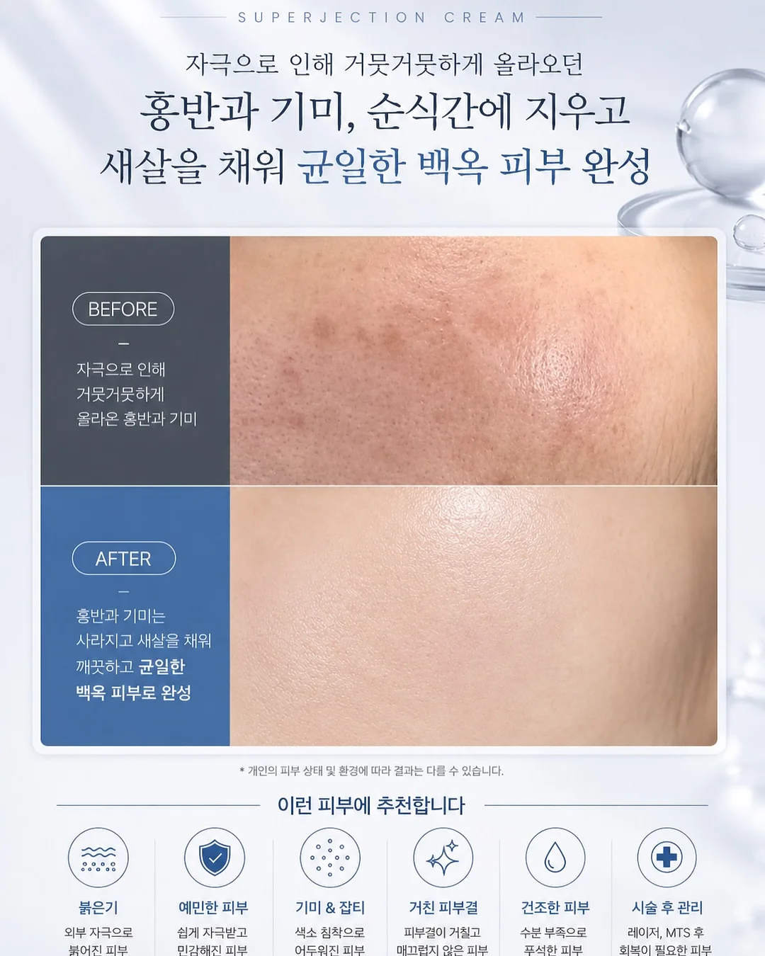 Redone 천사 나염T 5