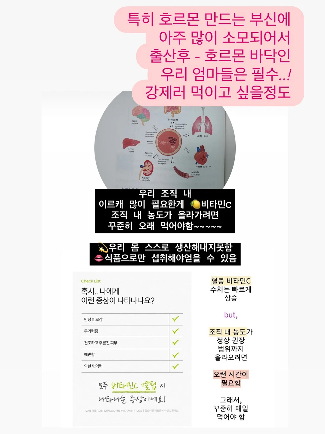 미니스커트 8