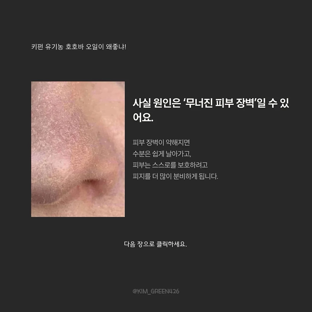치아바타 11