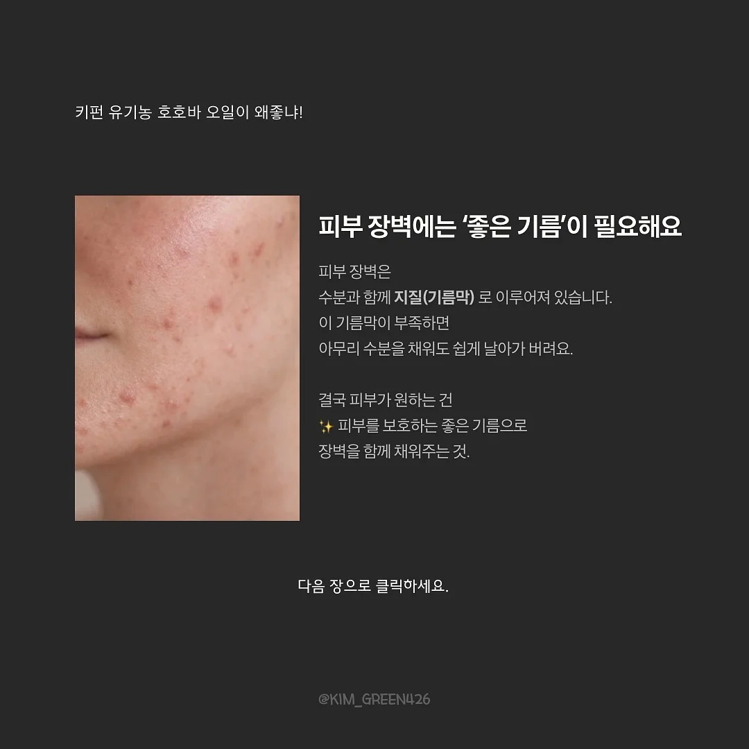 치아바타 10