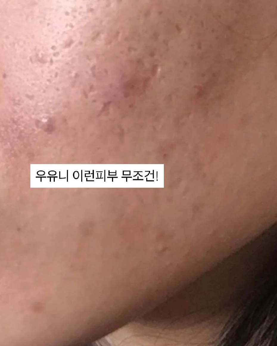 키즈 수영복 11