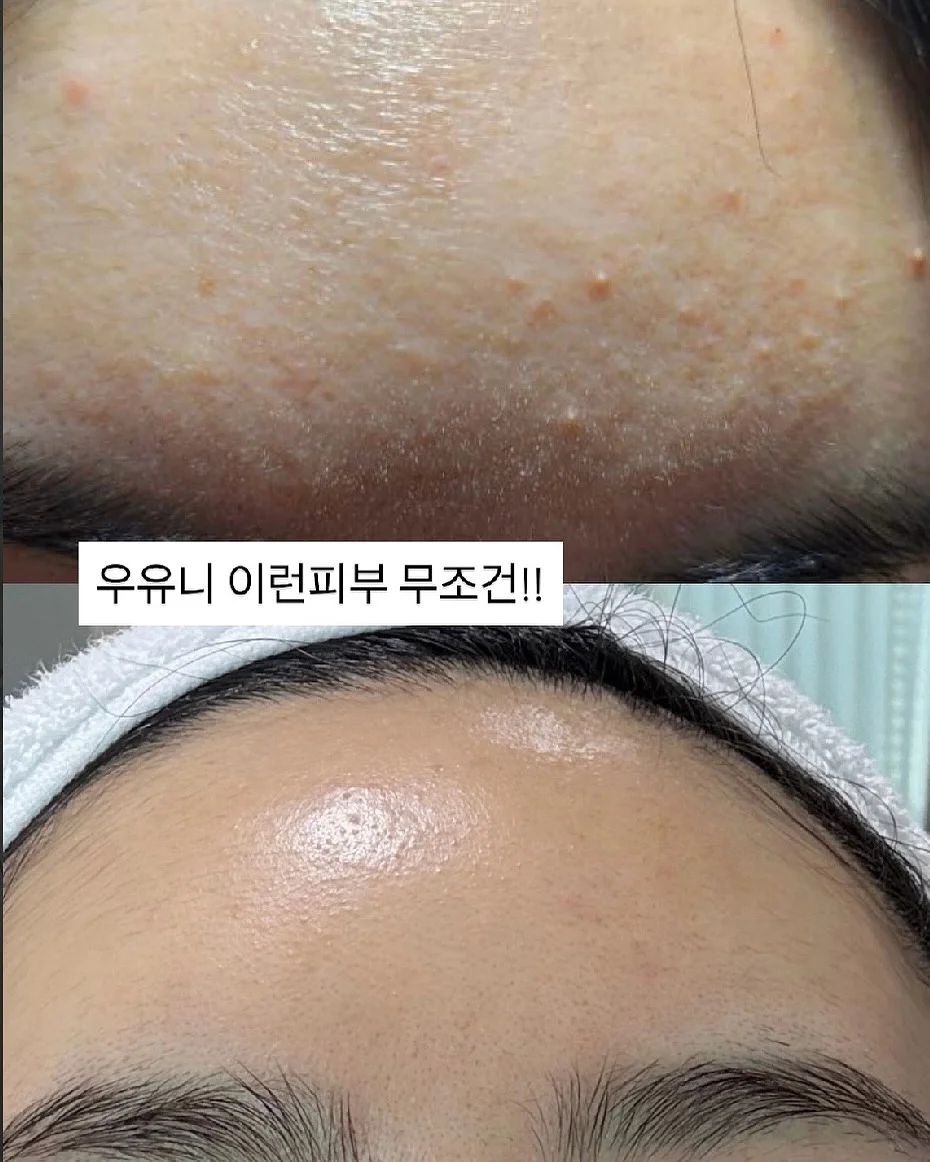키즈 수영복 10