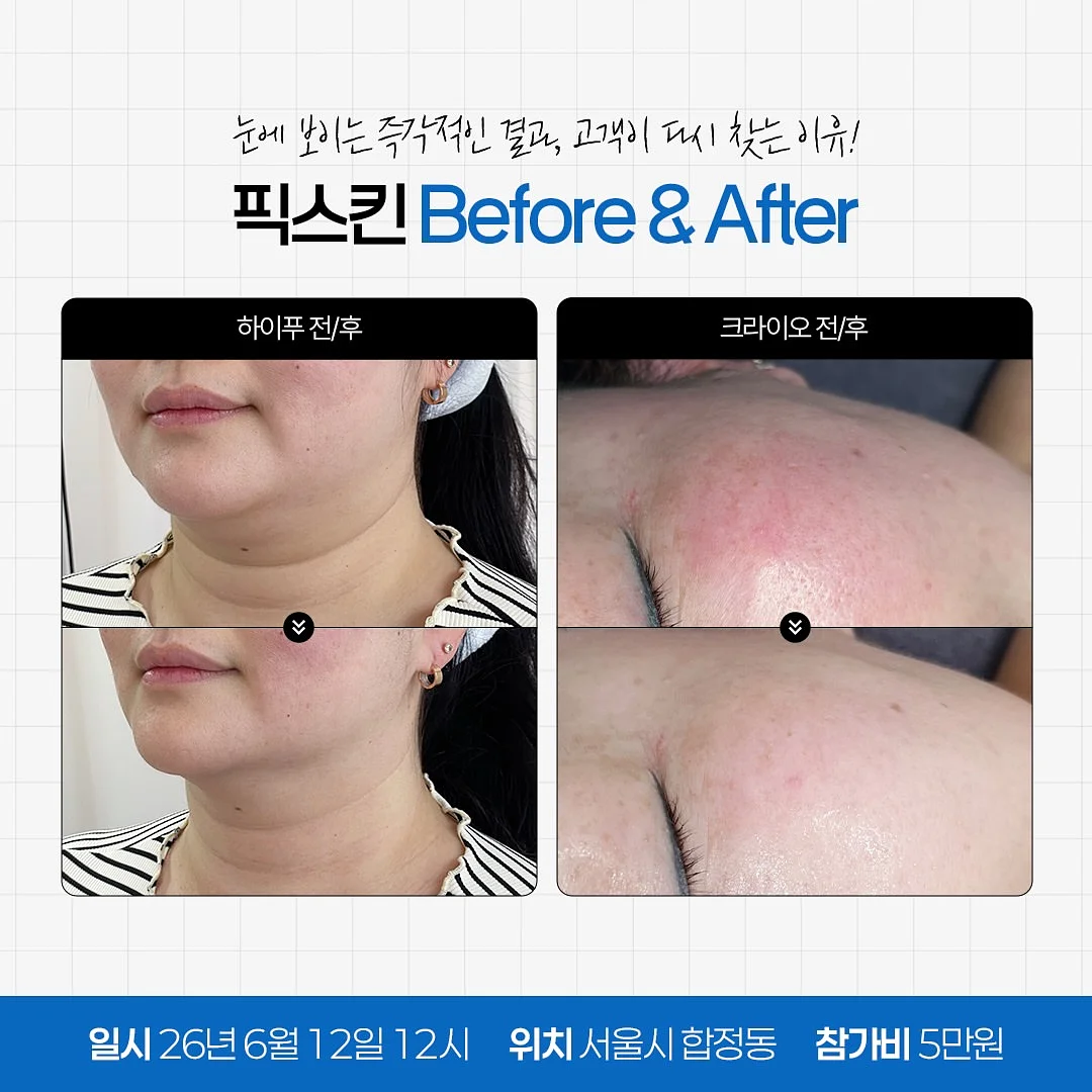 광채 올라오는 리셋템 3