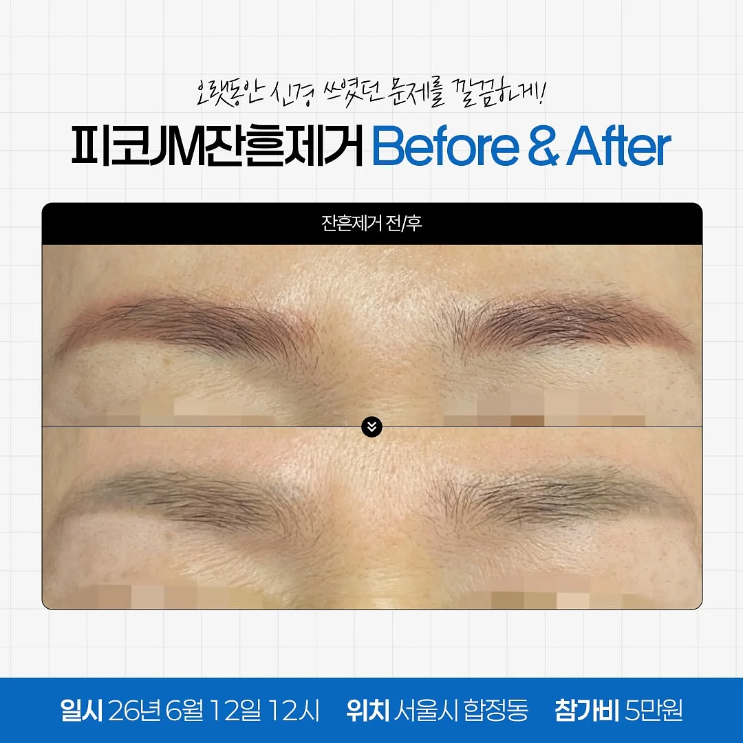 광채 올라오는 리셋템 4