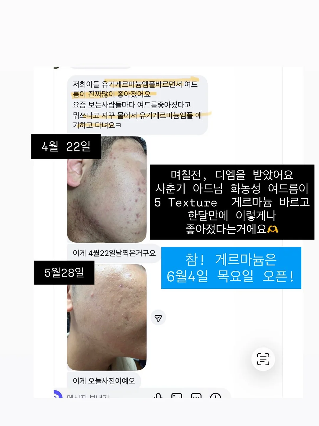 메디인랩 A3 앰플 17