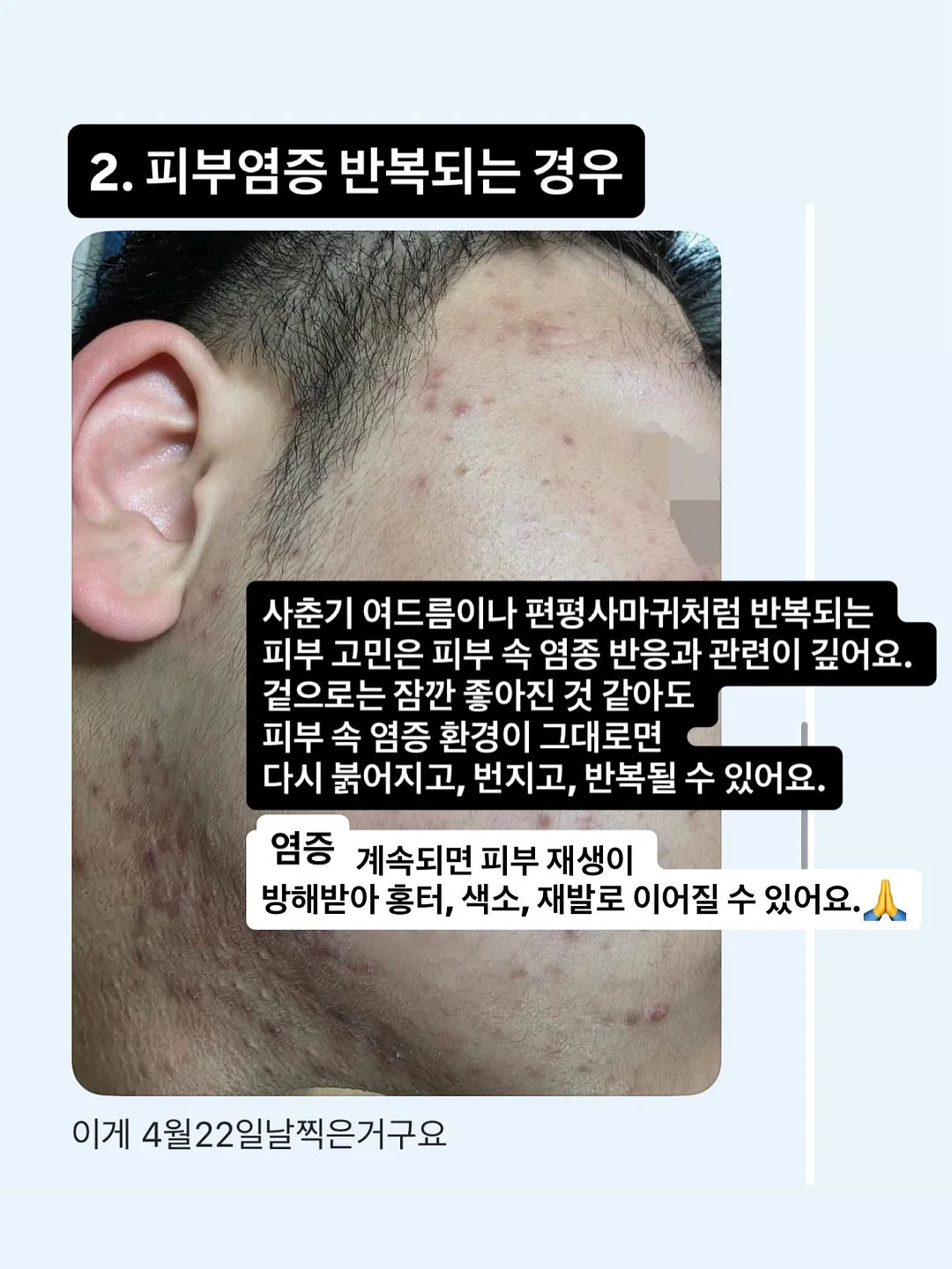 메디인랩 A3 앰플 4