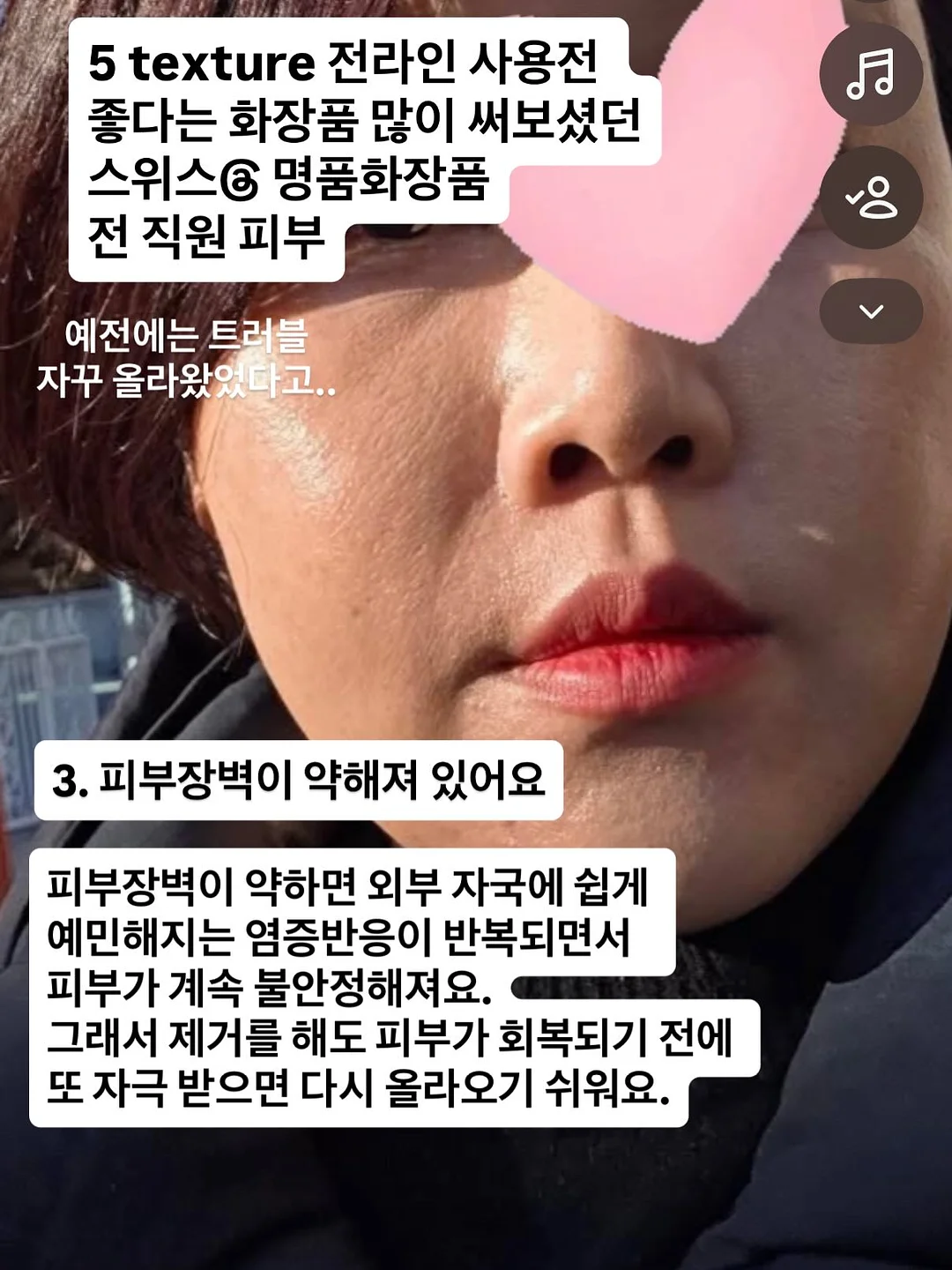 메디인랩 A3 앰플 5