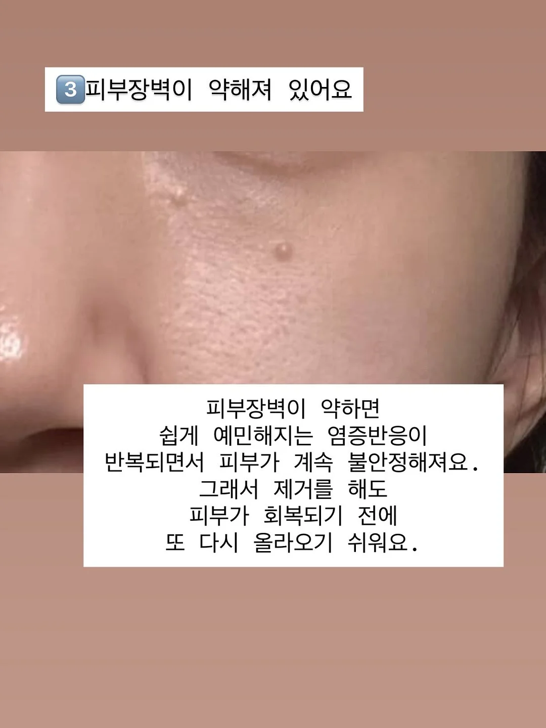 메디인랩 A3 앰플 7