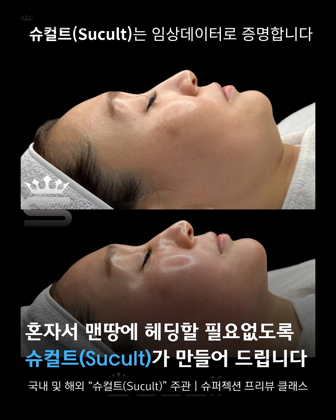 강아지 칫솔 16
