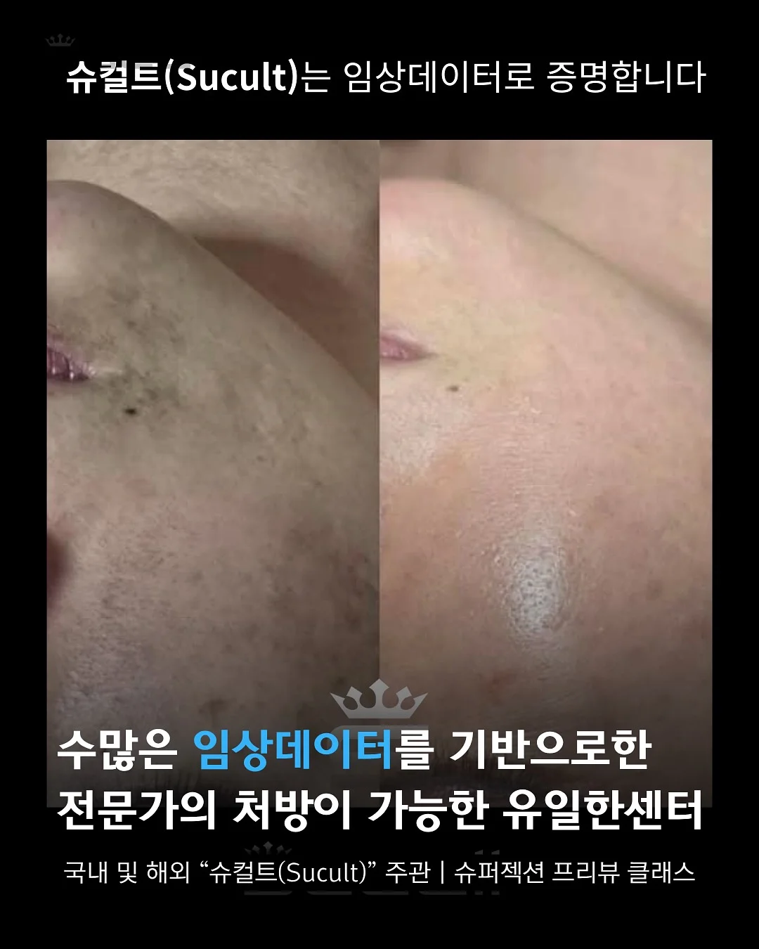 강아지 칫솔 17