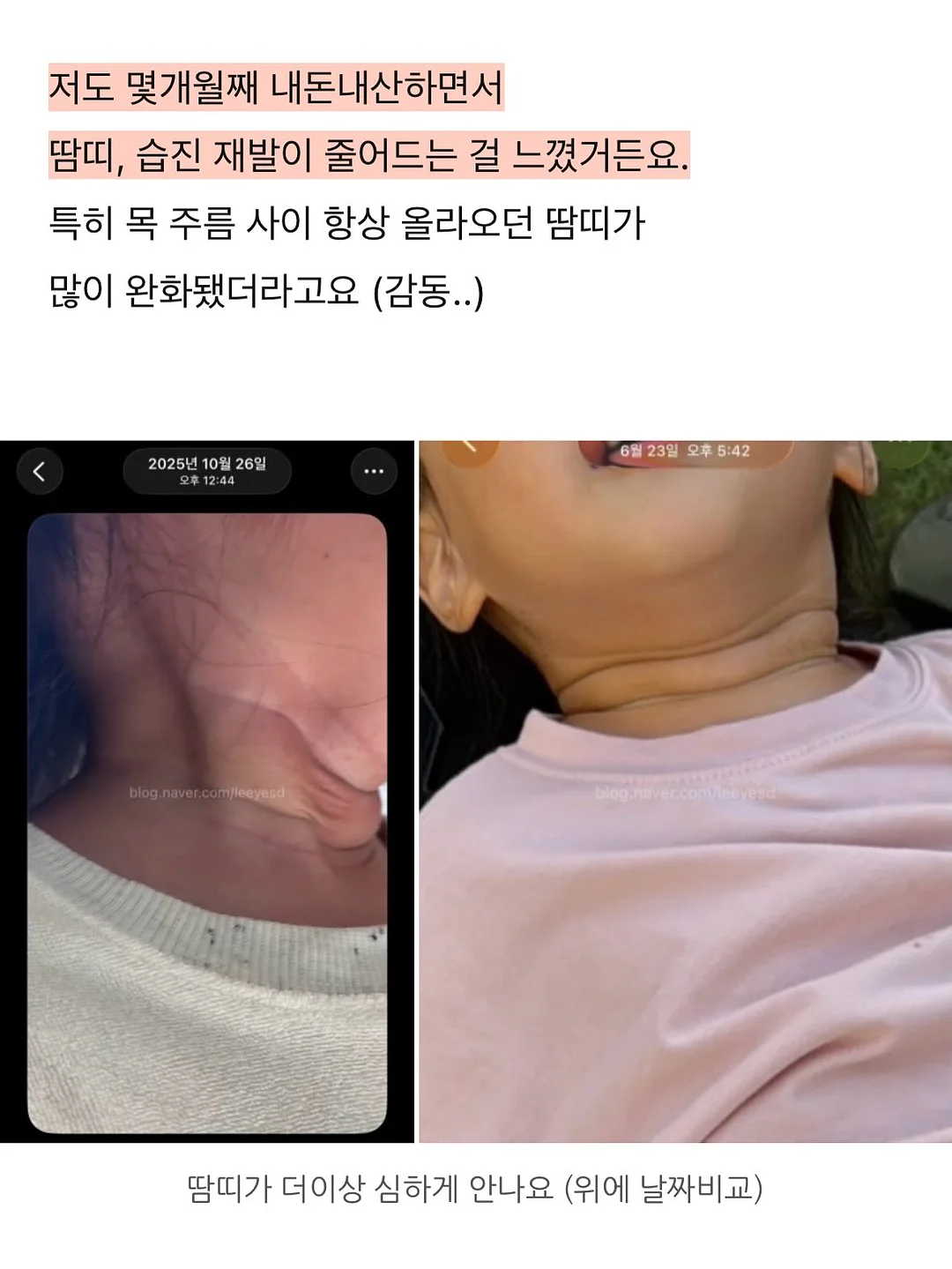 래쉬애딕트 18