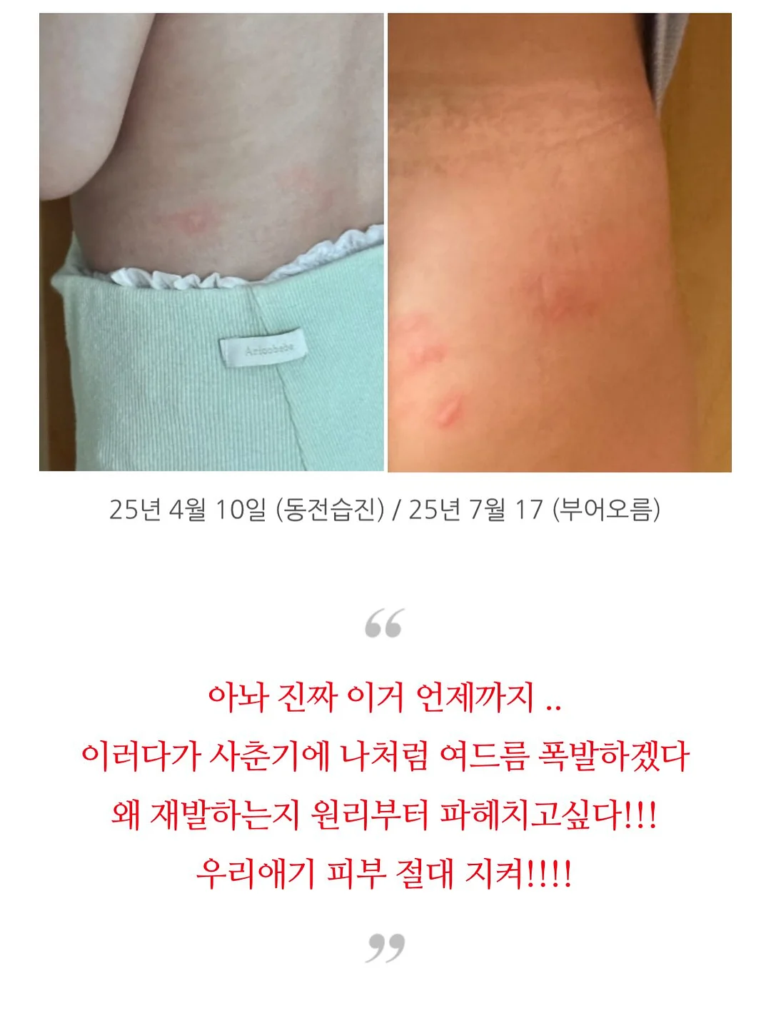 래쉬애딕트 4
