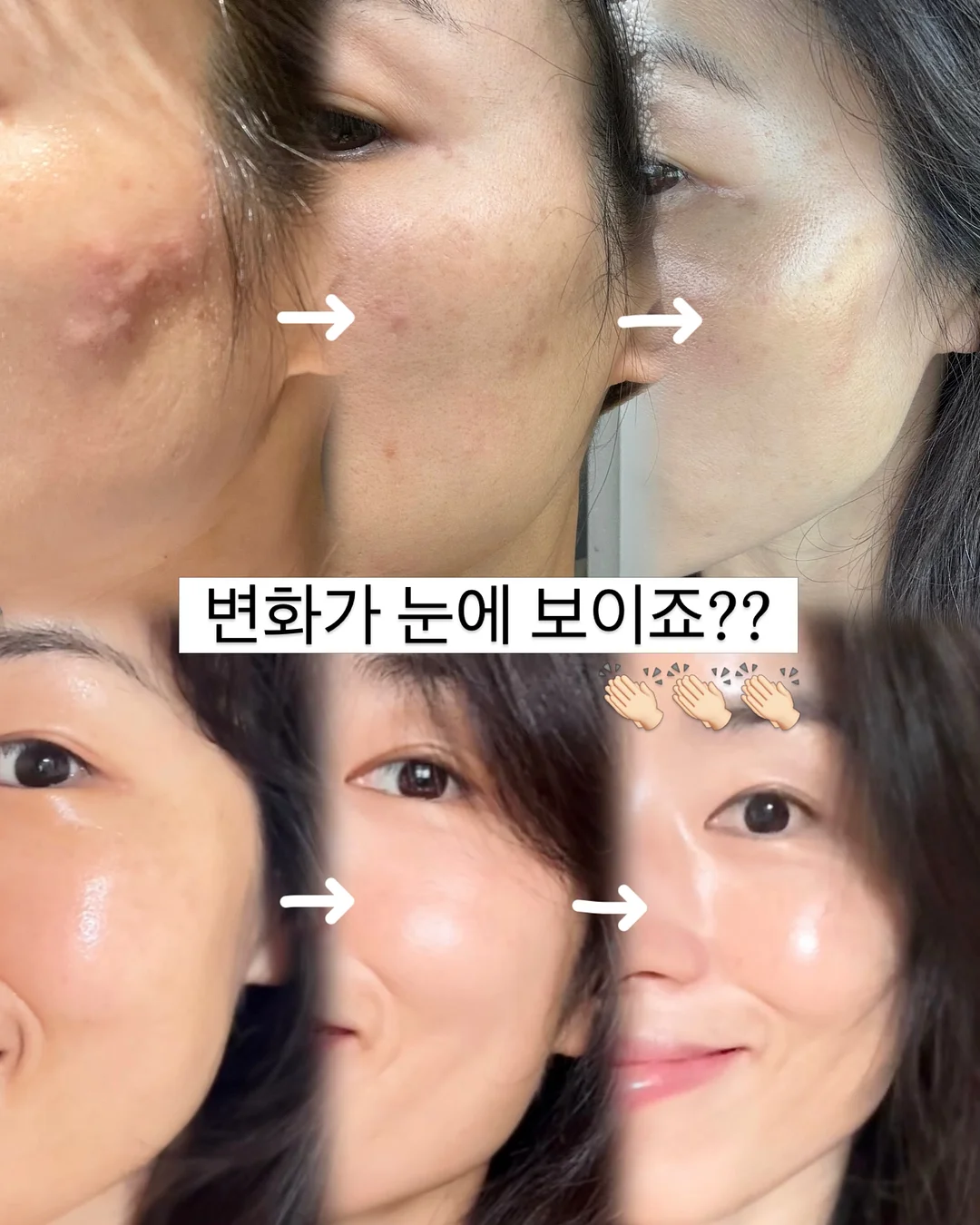 아기주스 테라피 13