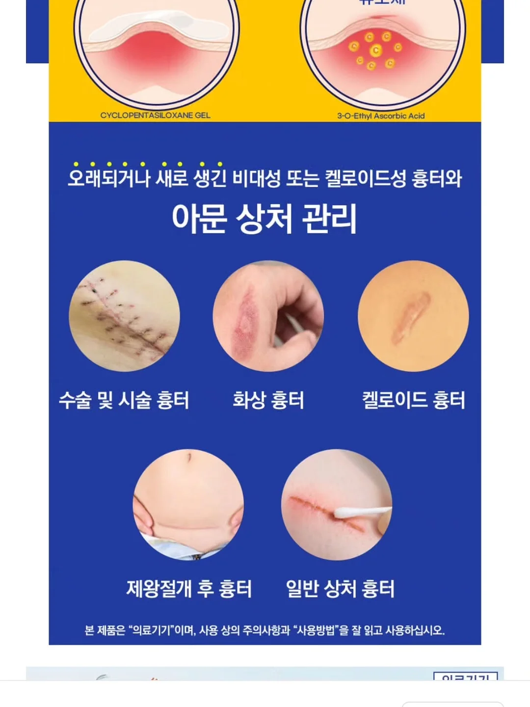 문라이트 이어링 11
