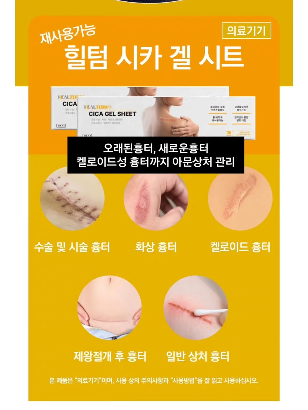 문라이트 이어링 8