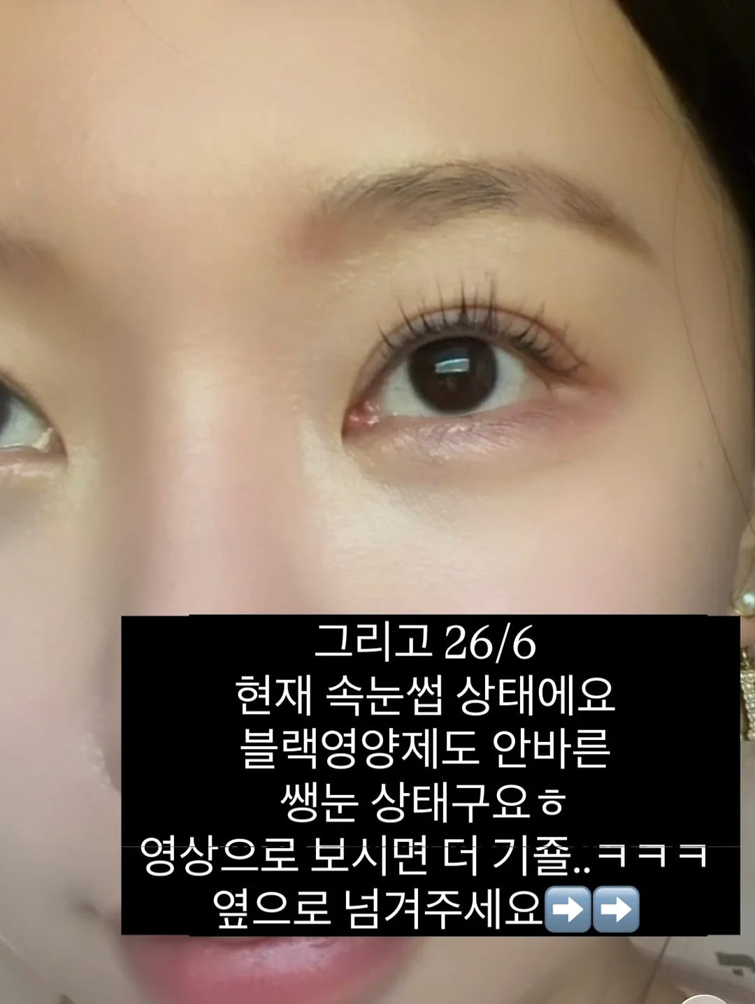 해변 그늘막 6
