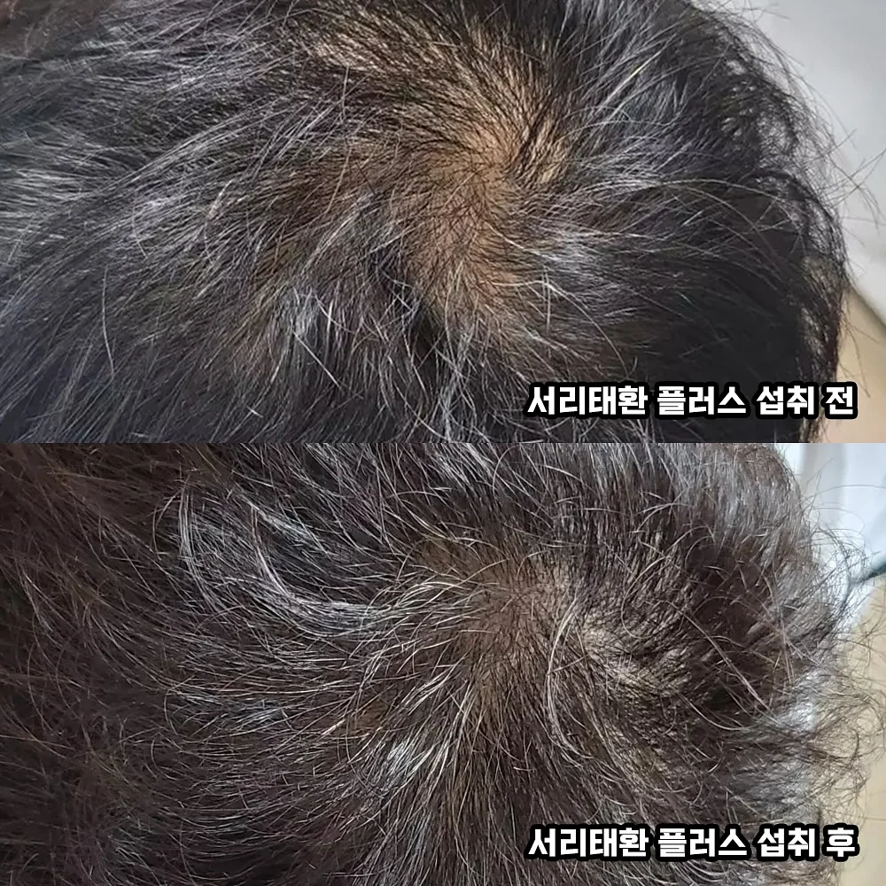 느타리버섯 1
