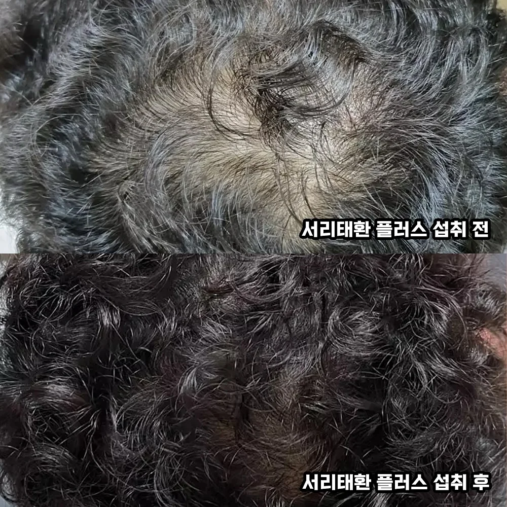 느타리버섯 2