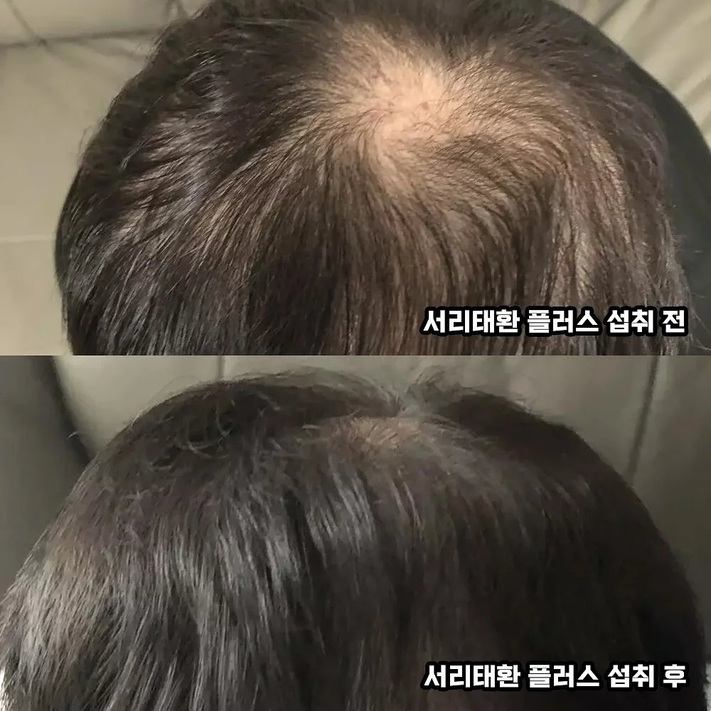 느타리버섯 3