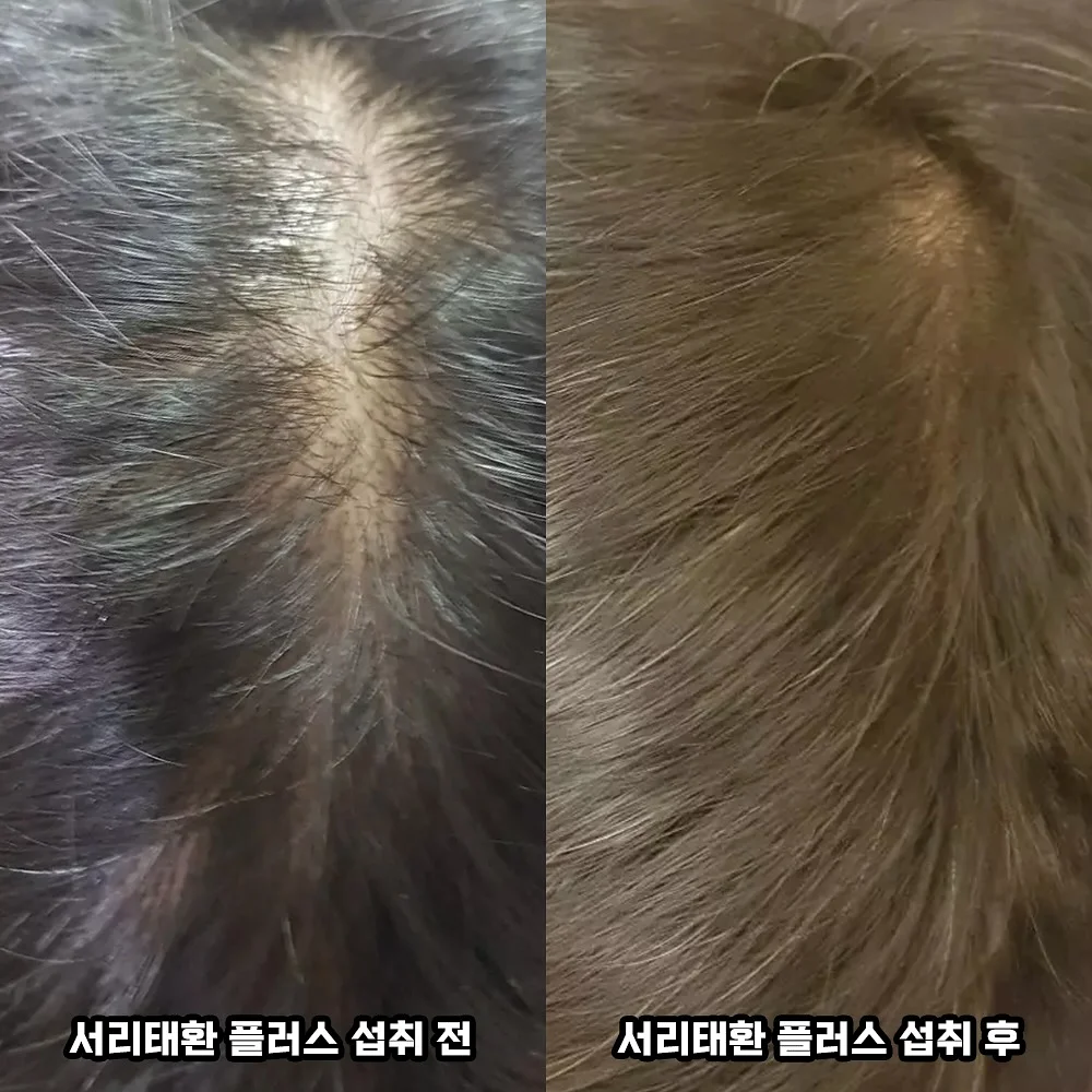 느타리버섯 5