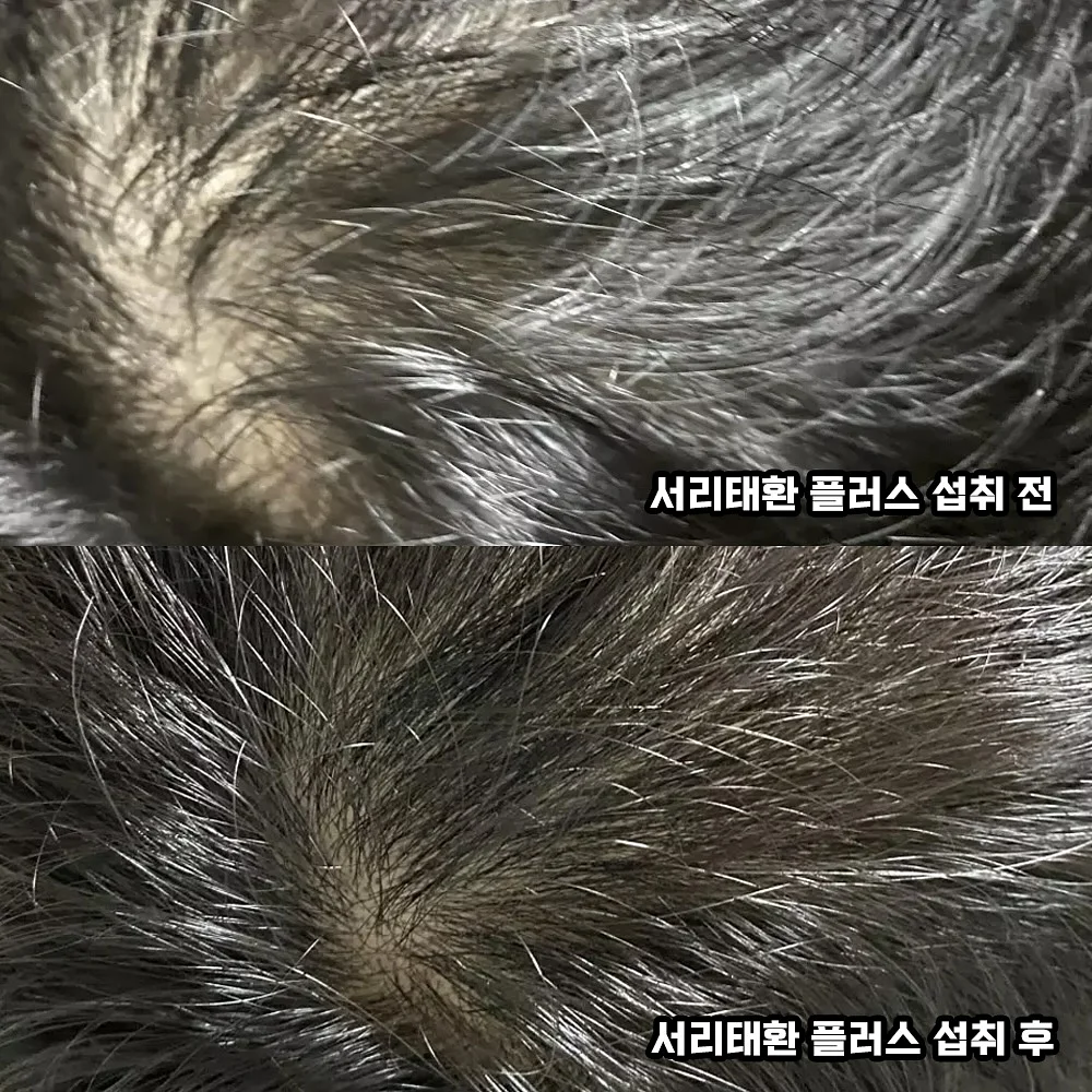 느타리버섯 6