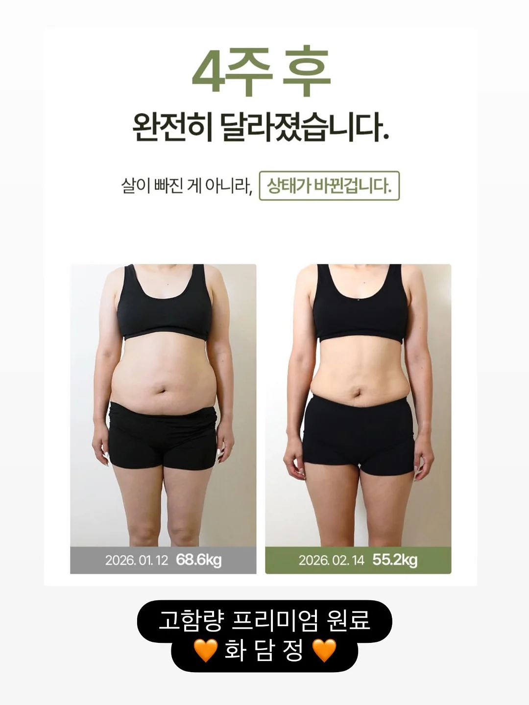 개말라 핏 코디 10