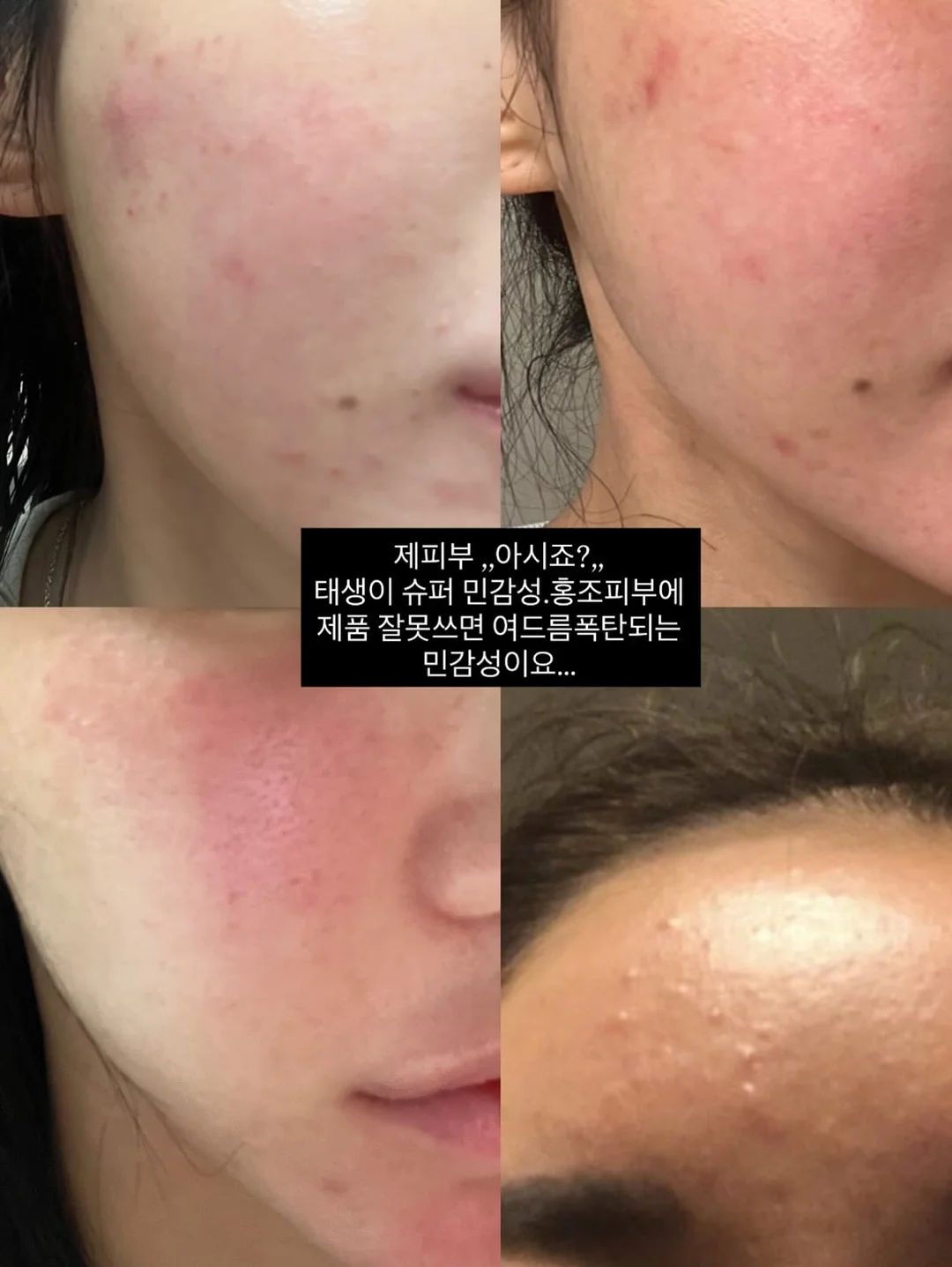 백일 여아 한복 3