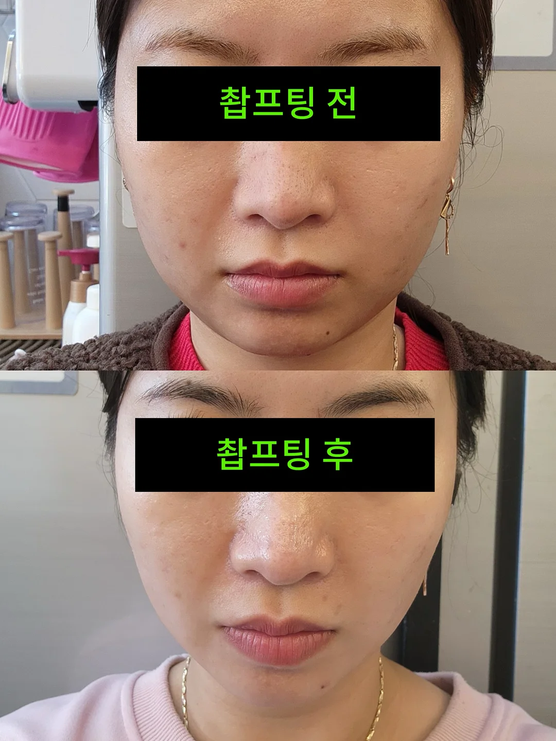 거래처 셀렉 제품 1