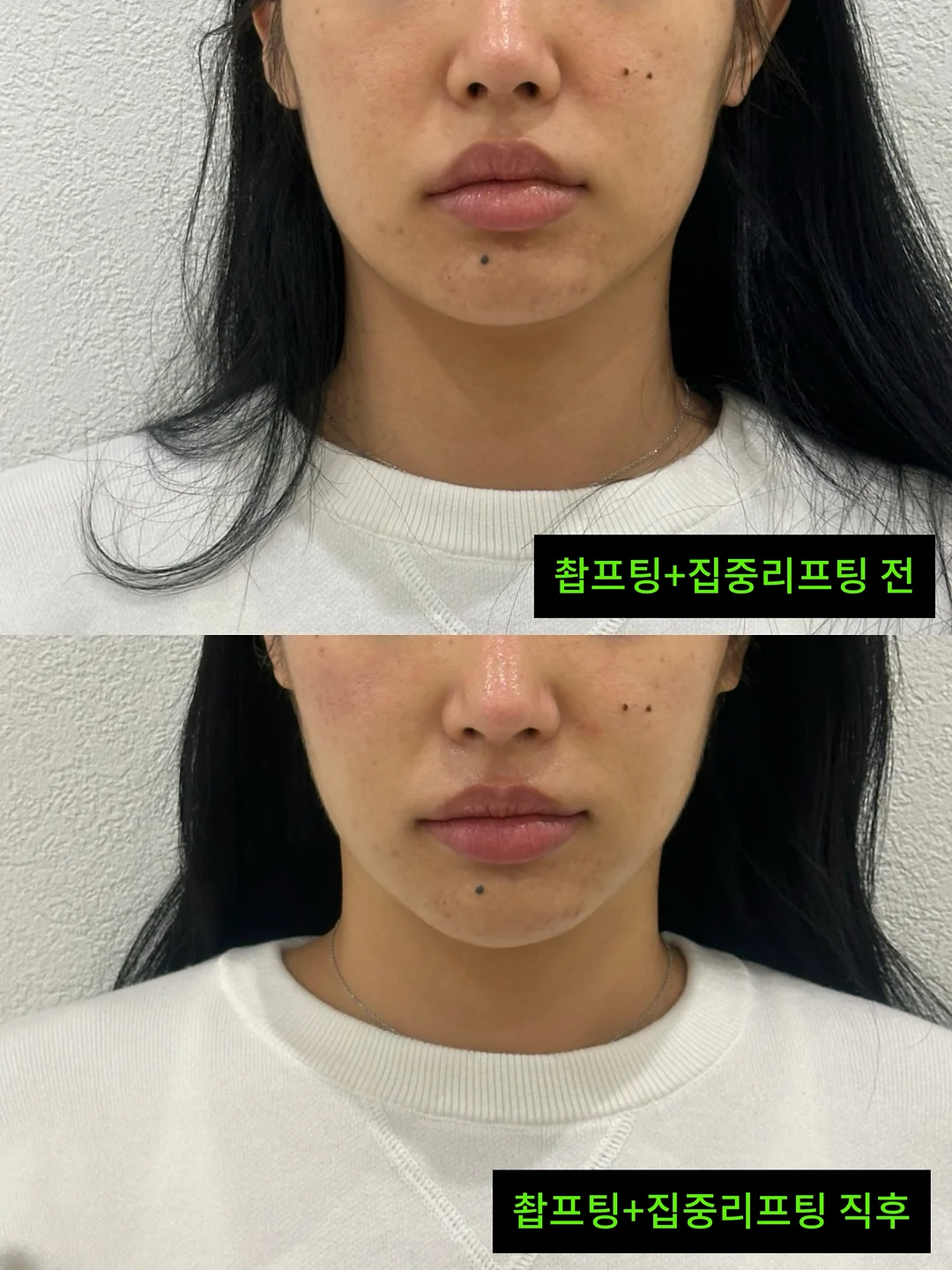 거래처 셀렉 제품 11