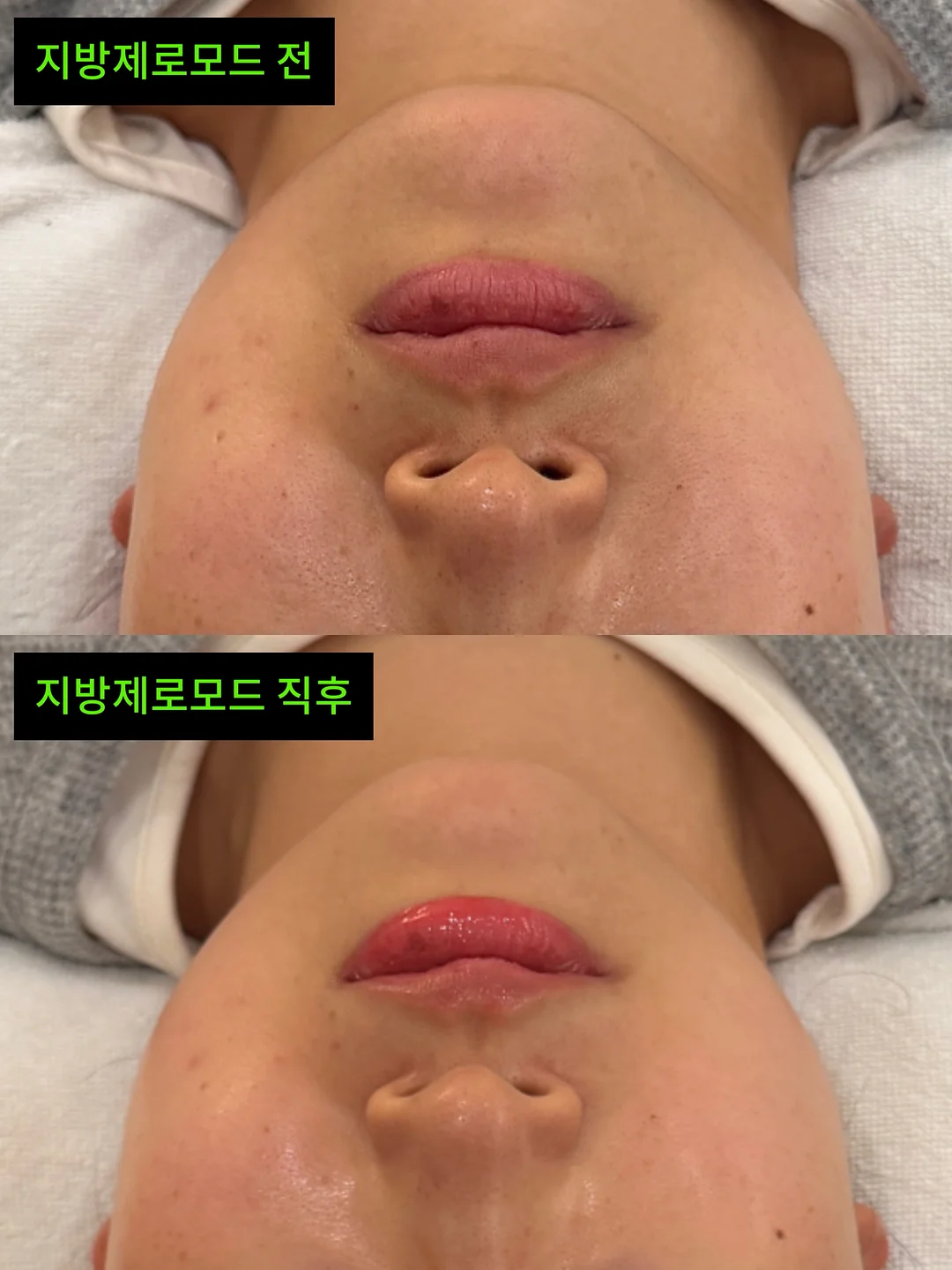거래처 셀렉 제품 12