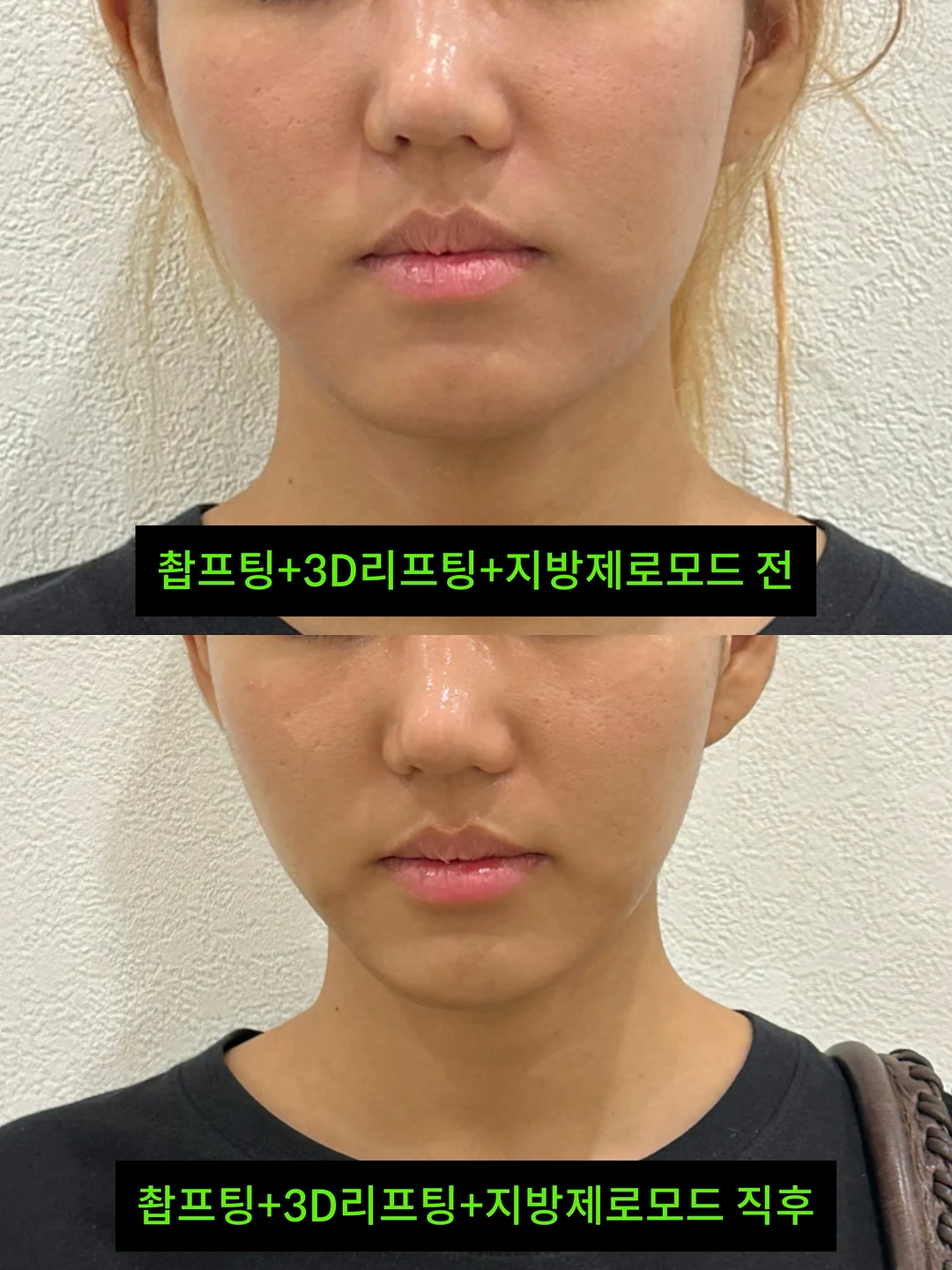 거래처 셀렉 제품 13