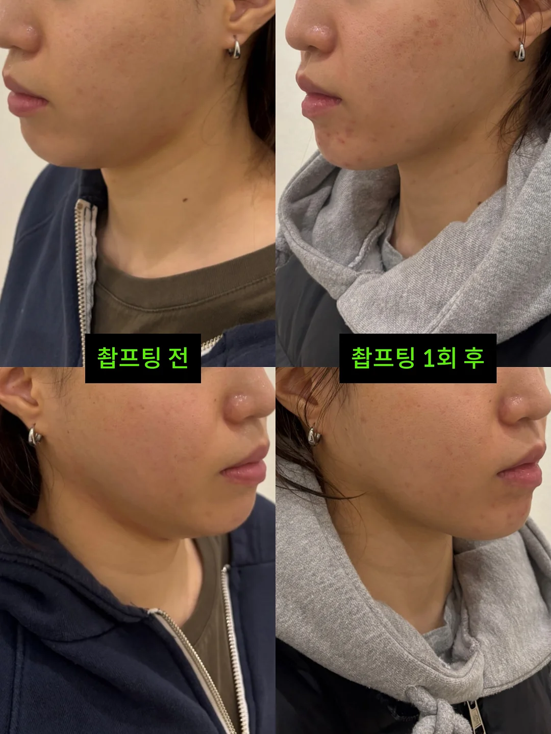 거래처 셀렉 제품 3