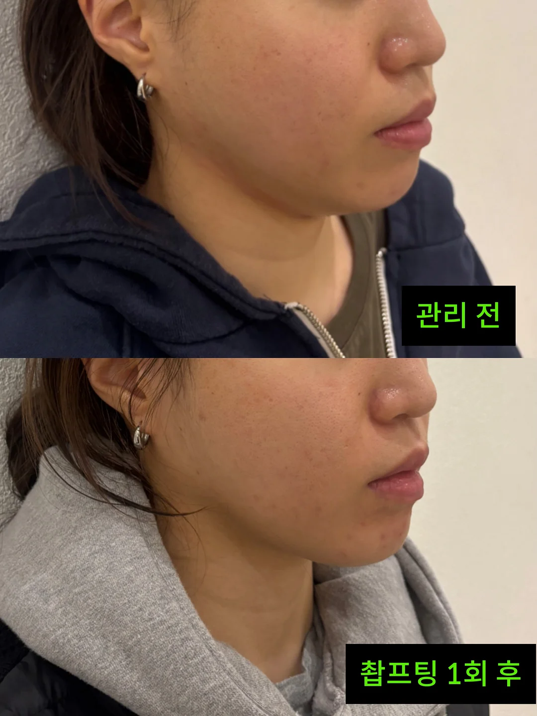 거래처 셀렉 제품 4